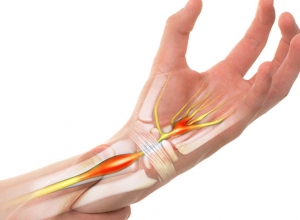 Tê bì chân tay ở người tiểu đường do tác nhân nào gây ra?